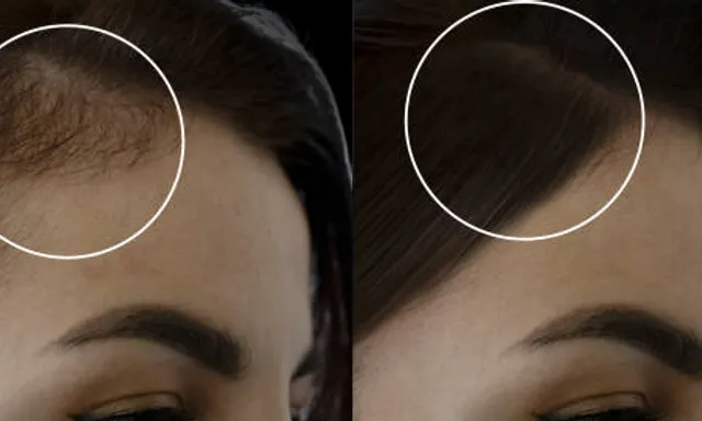 forehead, nose, lip, chin, vision care, eyelash, eyewear, jaw, ear, neck