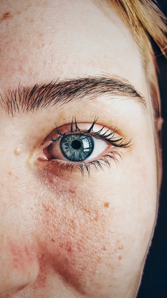 A close up of a person with freckles on their eyes - have the person have no freckles on their eyes and be in a different light. have the person have no freckles on their eyes and be in a different light